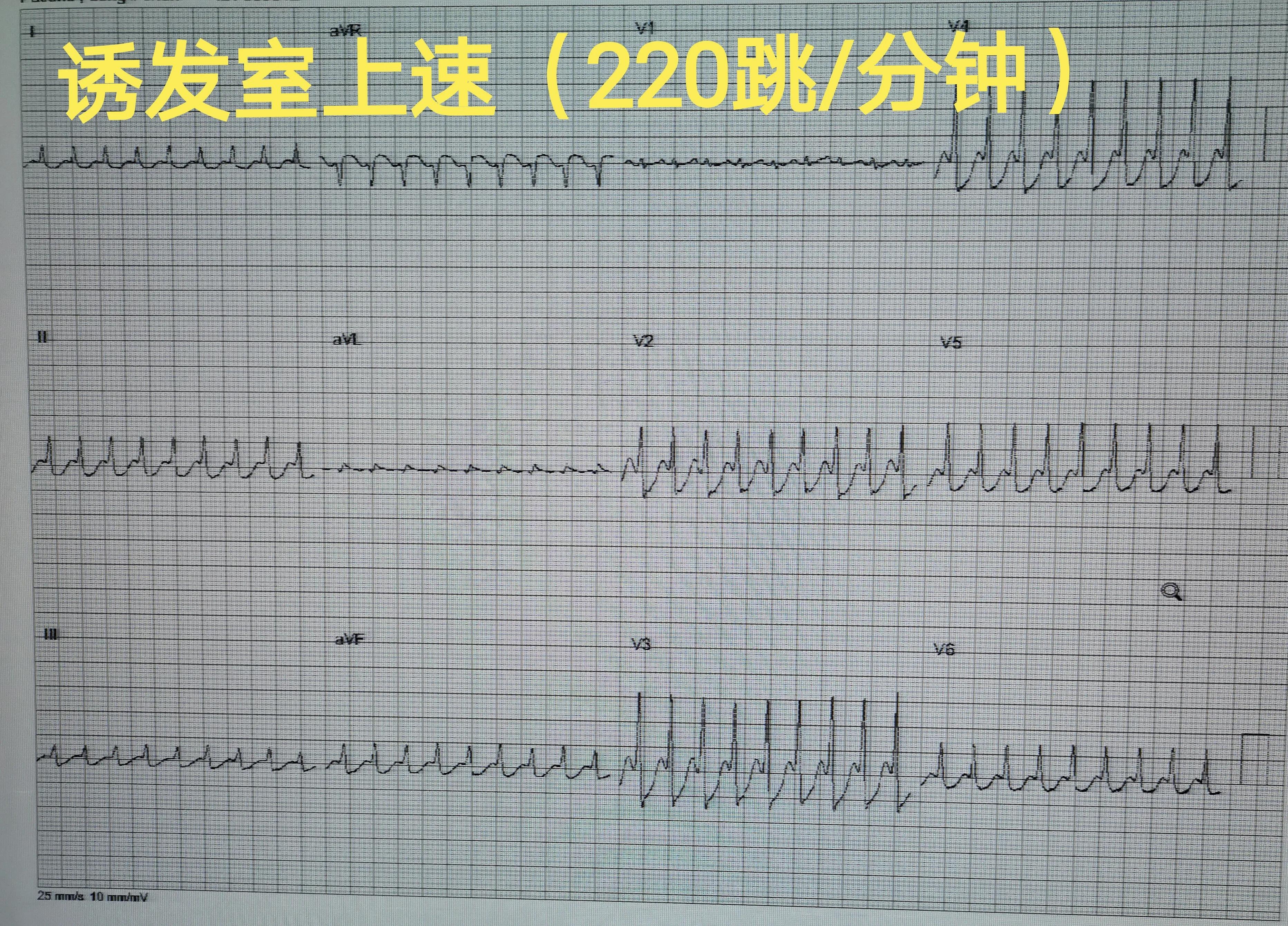 缁欒繙鍦ㄤ粬涔＄殑缃戝弸鎯呬功,缁欒繙鍦ㄤ粬涔＄殑缃戝弸瀵勪粈涔堢ぜ鐗╁ソ
