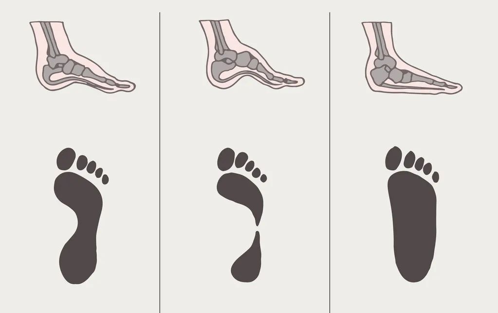 习惯性崴脚怎么锻炼脚踝力量,脚踝习惯性崴脚怎么恢复