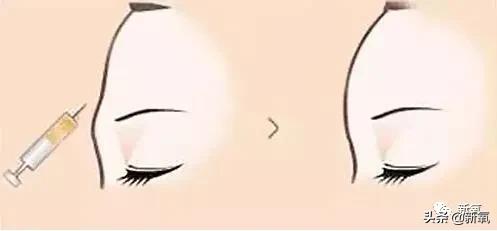 宁静和郑希怡对比,郑希怡和宁静对比