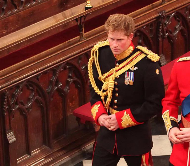 小贝为何剃光头,贝克汉姆的头秃