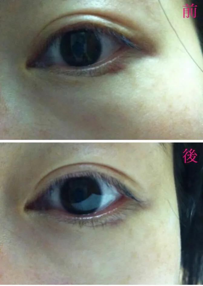 推荐的五款性价比高的眼霜,一款效果好而且性价比超高的眼霜