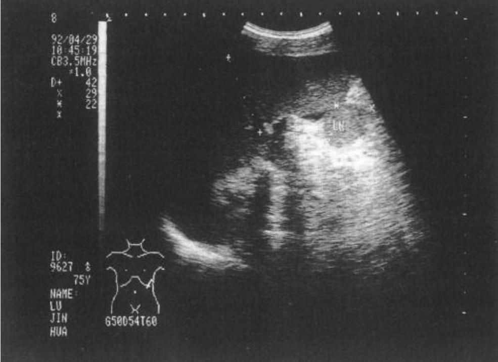 你以为妇产科的超声检查都是一样的吗？其实大有区别哦