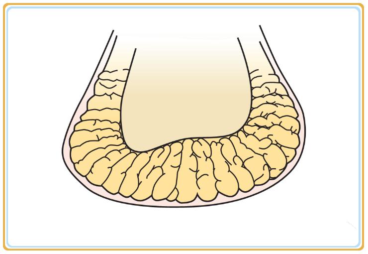 中老年人脚底痛是什么原因,老人脚底板好疼是什么原因