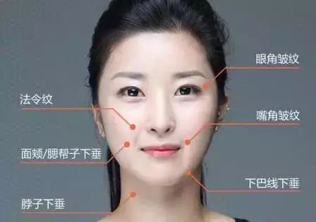 线雕第八天脸更大了,皮肤很松垮能做线雕吗