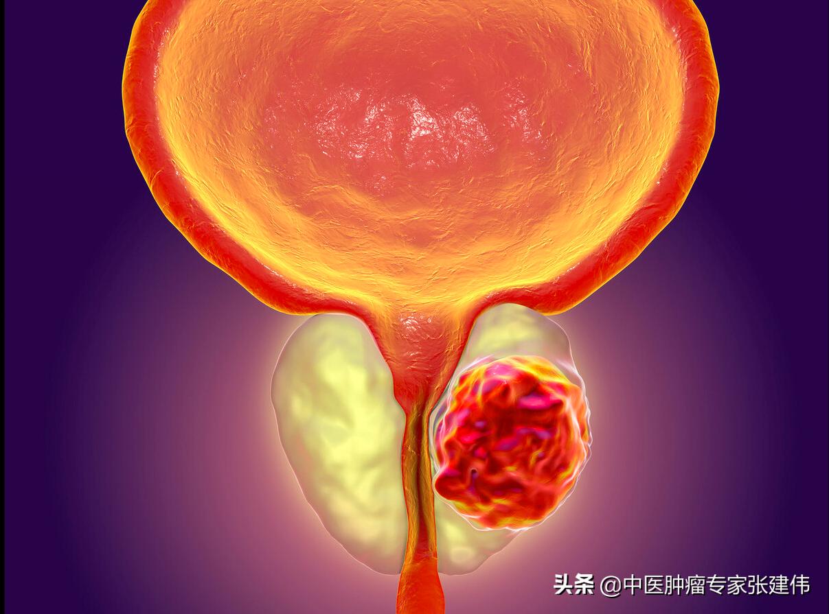 为什么男人得癌几率高,男人癌有哪些