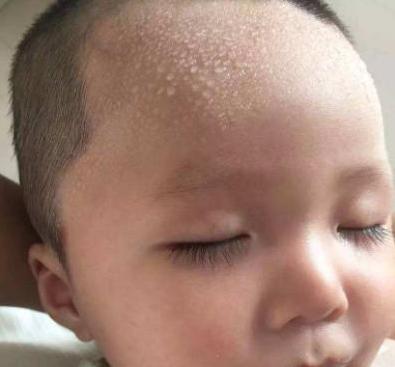 脾胃虚的5种表现，很多孩子都中了！一水果一食材，妈妈巧养胃