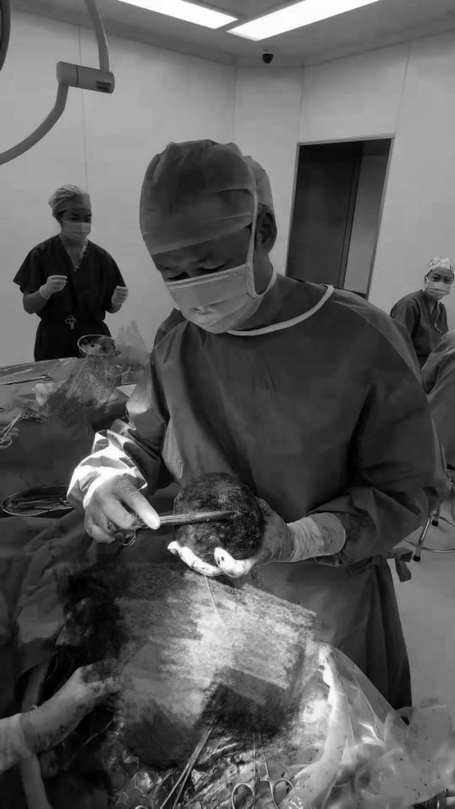 罕见病例!剖宫产中孕妇子宫肌瘤竟有胎头般大小