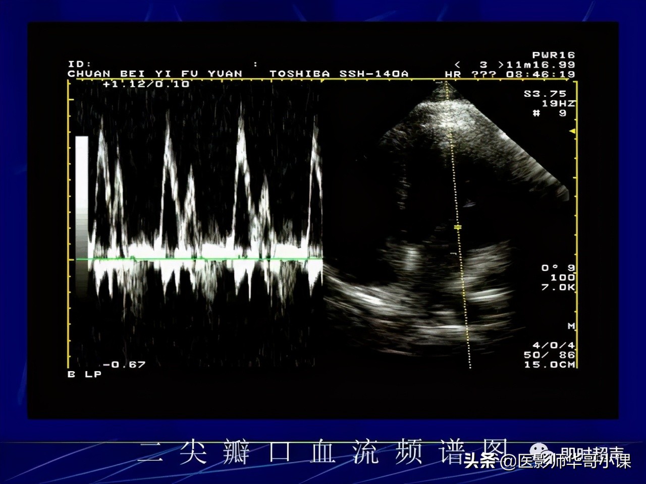 超声检查报告单讲解,超声图像检查