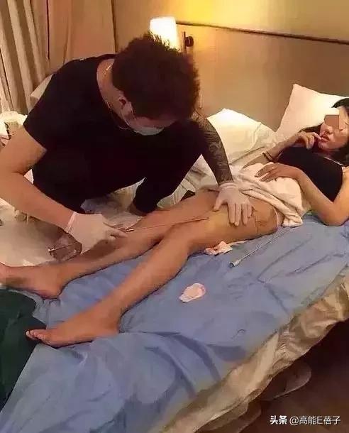 微整形需要多久,最受欢迎的5大微整形