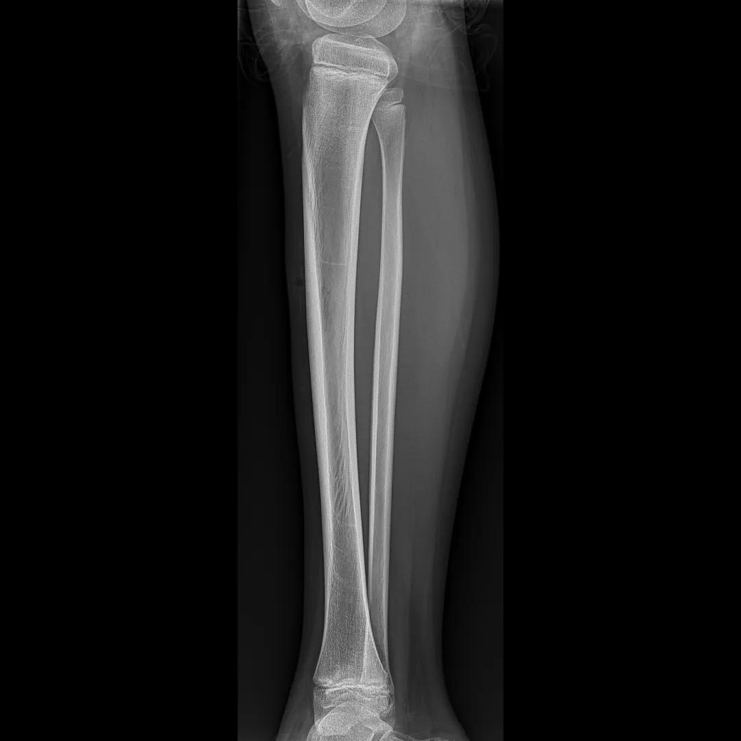 安健科技dr拍片质量怎么样,安健科技DR价格