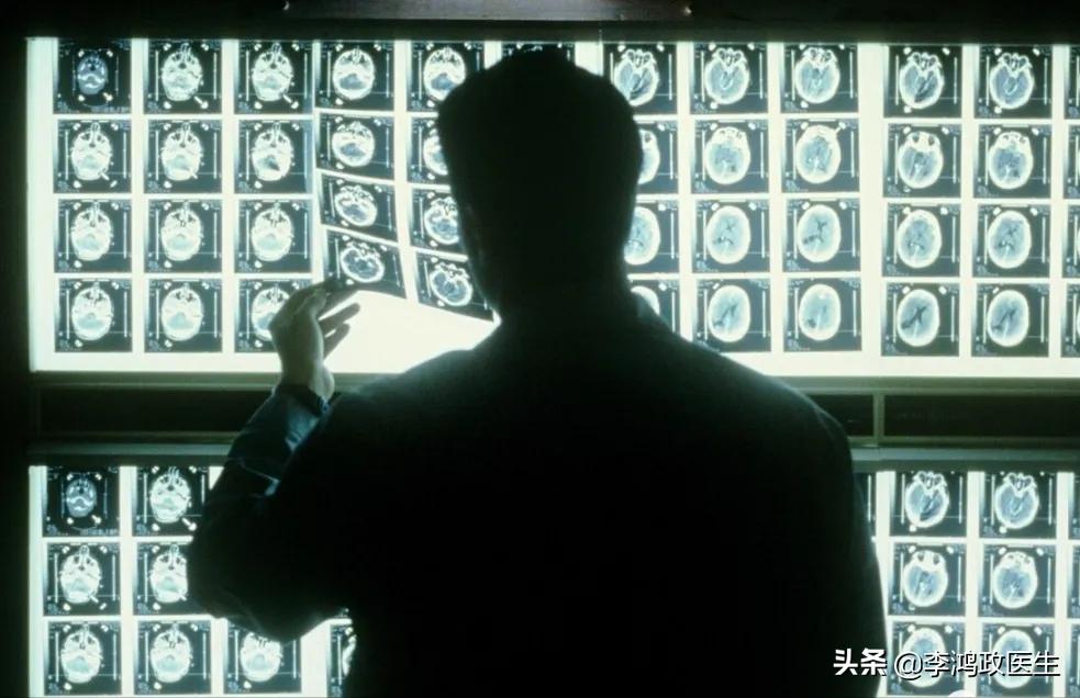 眼睛痛医生让拍ct预示很严重吗,男子眼睛痛检查失明