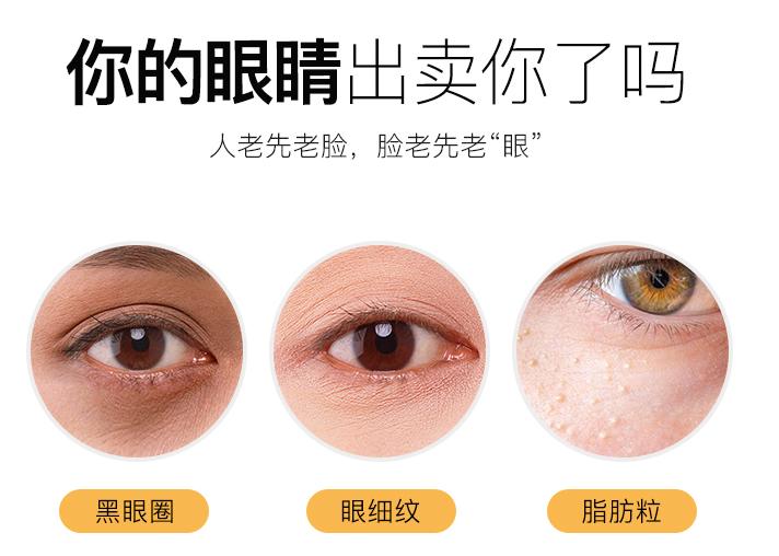 别再用针挑！用米澳拉，脂肪粒自己“掉”下来，效果胜过医美激光