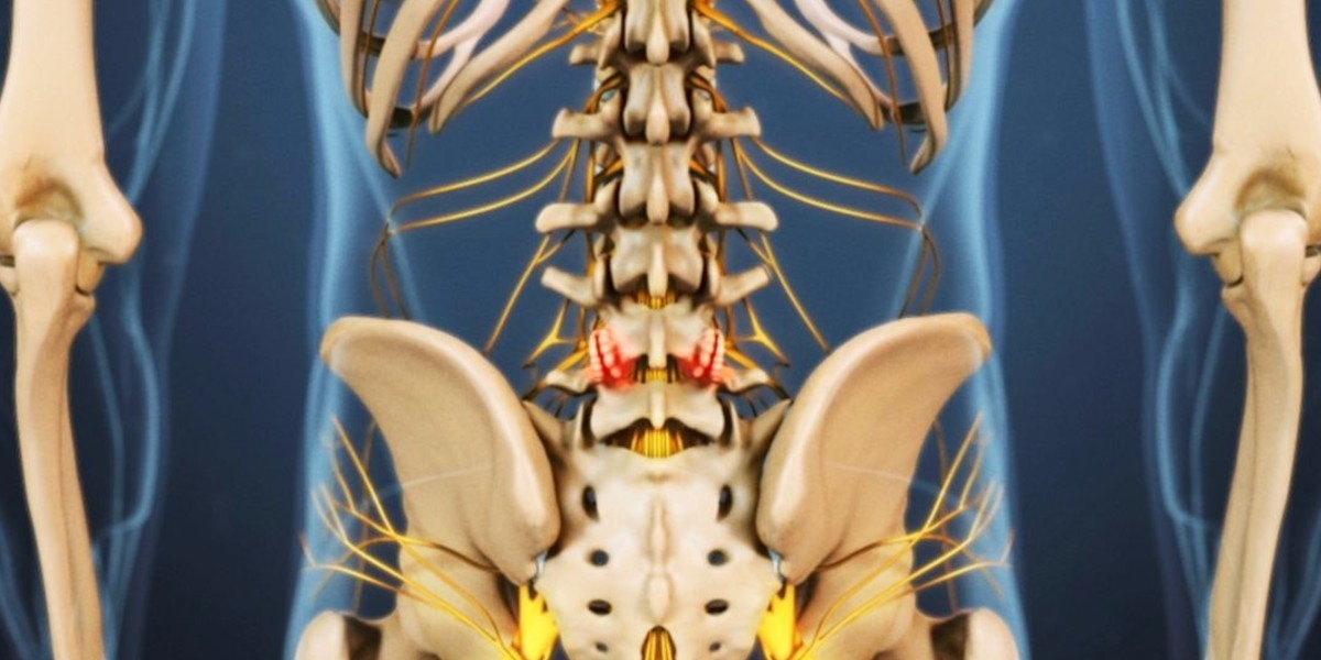健身腰伤怎么快速恢复,锻炼腰肌出现疼痛