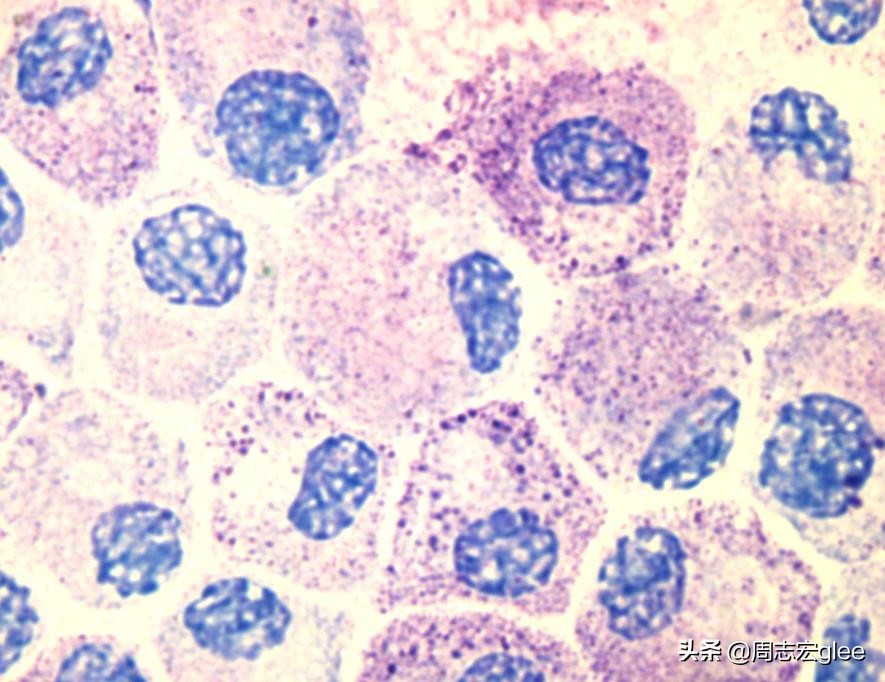 蚊虫叮咬一直痒怎样治,蚊虫叮咬越挠越痒怎么办