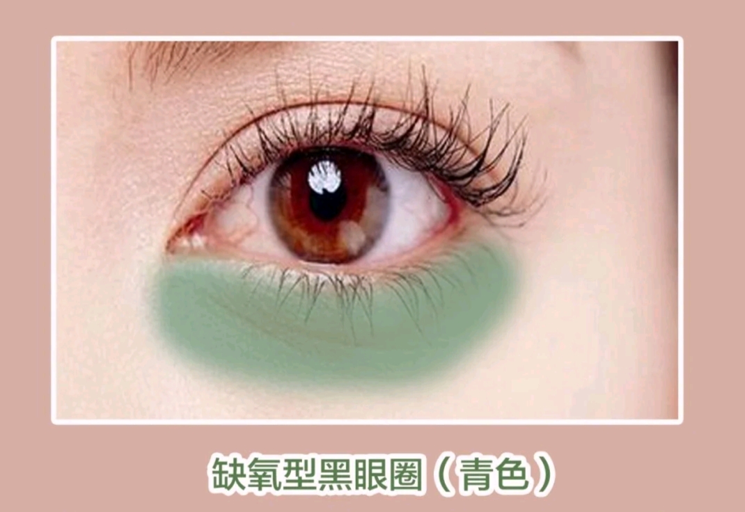 你的黑眼圈从哪来,你的黑眼圈是什么颜色