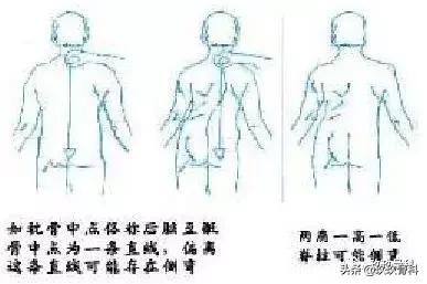 骨科术前术后注意事项,骨科手术体位安置标准流程