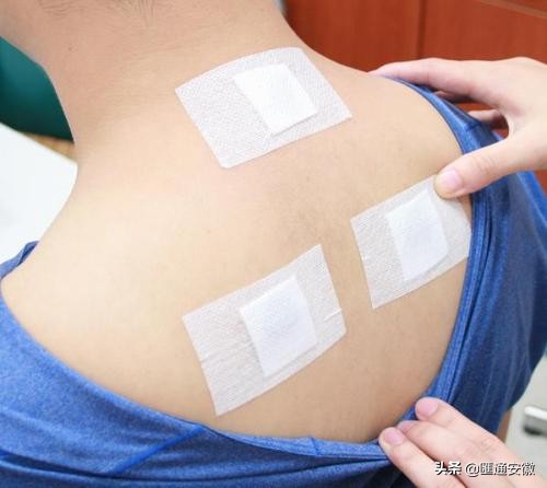 冬病夏治三伏灸火爆预约中,冬病夏治三伏贴哪家好