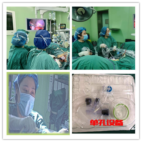 妇科单孔腹腔镜新技术新项目,妇幼单孔腹腔镜