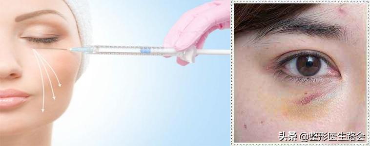 用什么样的眼霜可以缓解泪沟眼袋,眼袋和泪沟用眼霜效果好吗