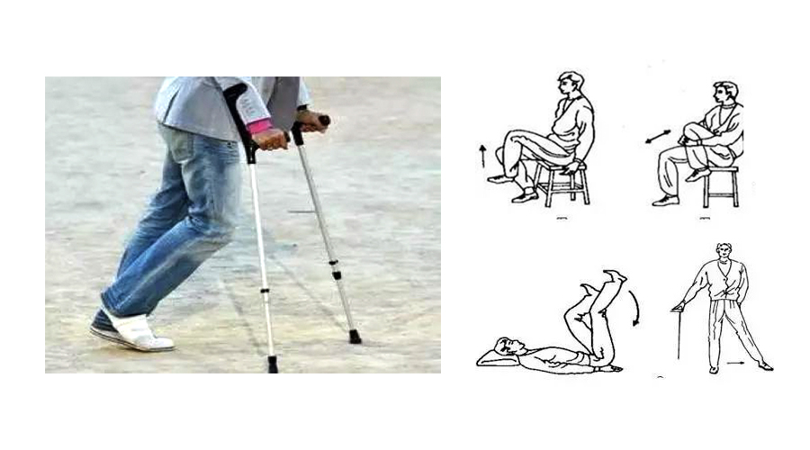 早期股骨头坏死康复锻炼,股骨头坏死康复锻炼