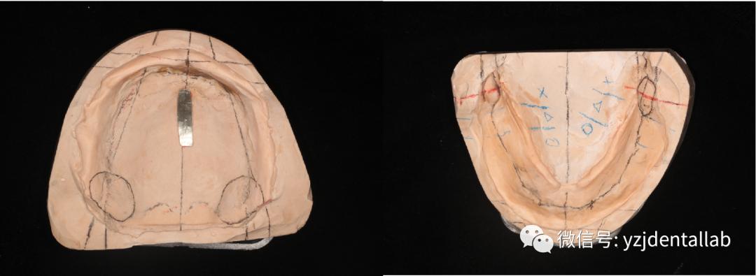 病例教学视频,病例分析操作技能