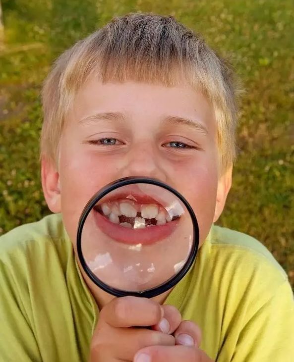 换牙门牙缝隙多大算正常,小孩换牙的门牙缝隙大图片