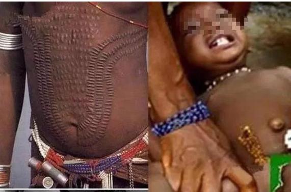 熨平少女胸部！揭秘非洲可怕习俗“烫乳”