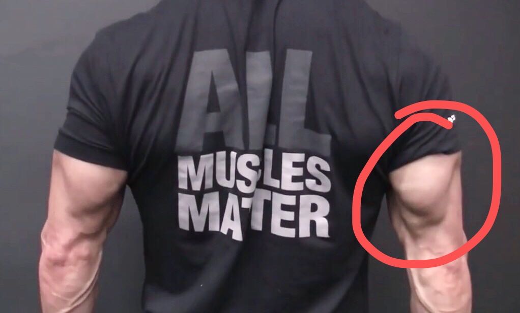 练不出麒麟臂的原因,简单实用的麒麟臂练法