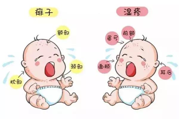 小孩子天气热长痱子怎么办,孩子天热出痱子怎么办