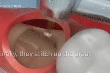 医生手术后最想做什么,医生做完手术以后会怎样