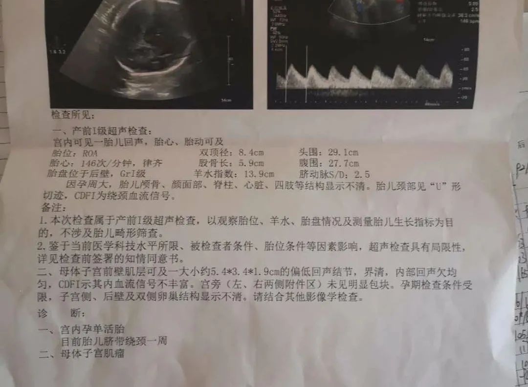 孕期一共做几次b超检查,孕期需要做几次b超检查