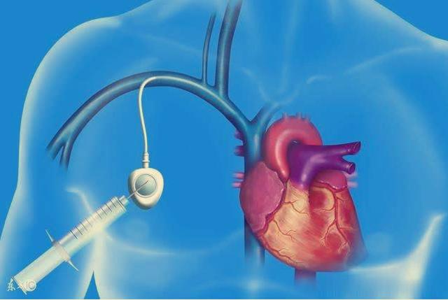 妈妈肺癌化疗失败之后，靶向治疗效果很棒！但如何解决耐药问题？