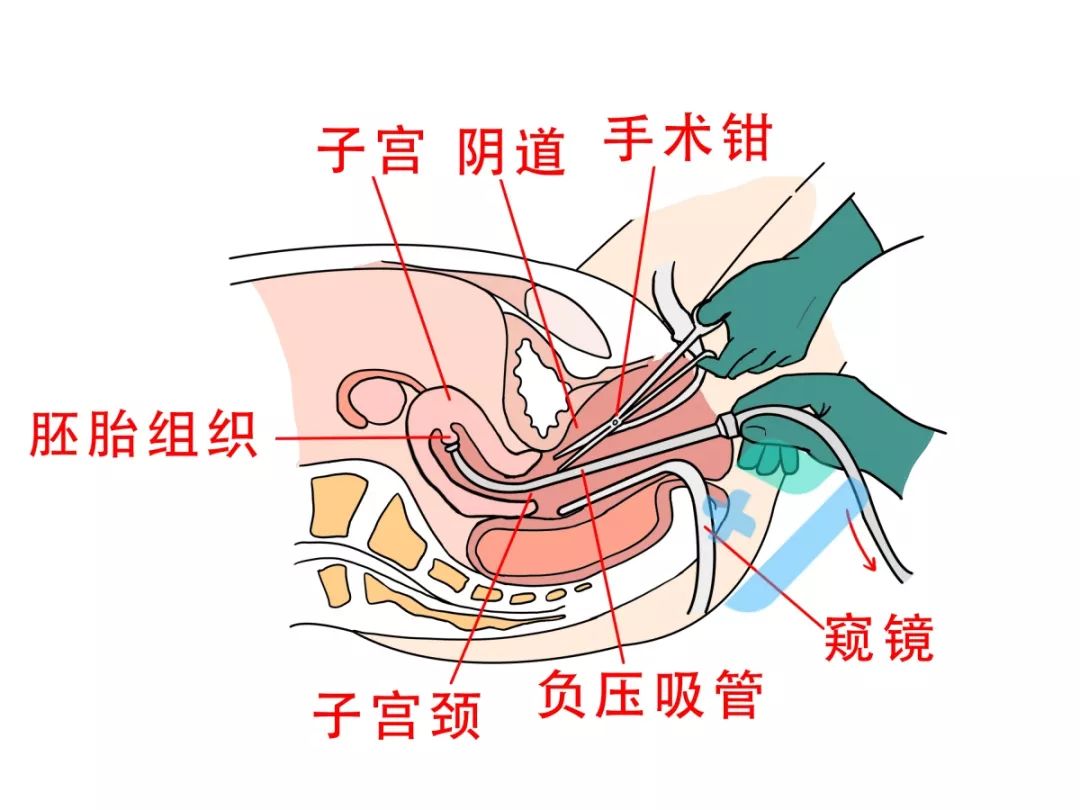 夫妻检查都正常为啥怀不上孩子,夫妻双方正常为什么怀不上孩子