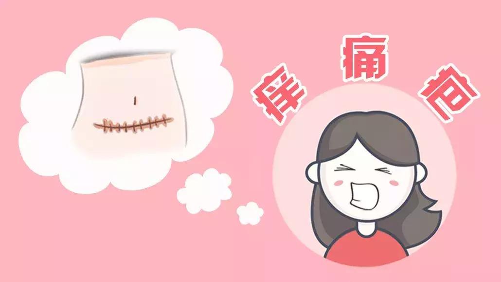 产后侧切刀口痒是怎么回事,产后刀口痒怎么回事