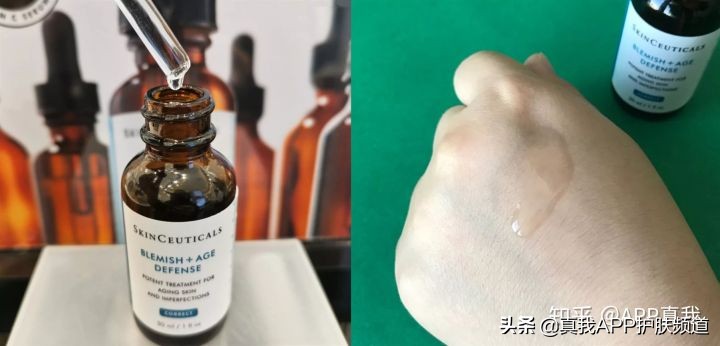 维a酸药膏治疗痘痘效果,中成药维a酸类口服药有哪些