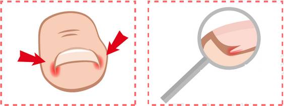 生活小常识脚趾甲,指甲小知识大全