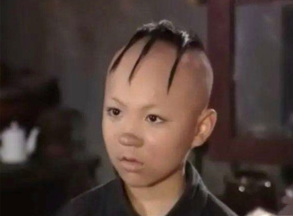 “三毛”34岁了！8岁爆火，14岁谢顶，植发挨300多针，如今变帅哥