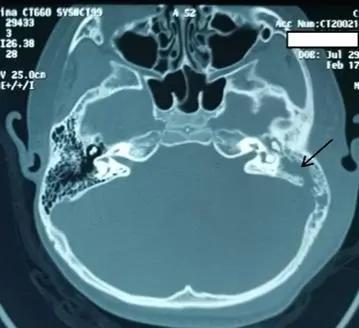儿童新冠防疫的科普知识,防疫病毒科普知识幼儿