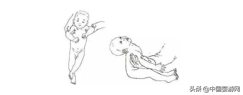 宝宝歪头怎样牵拉纠正,婴儿歪头平躺可以纠正吗