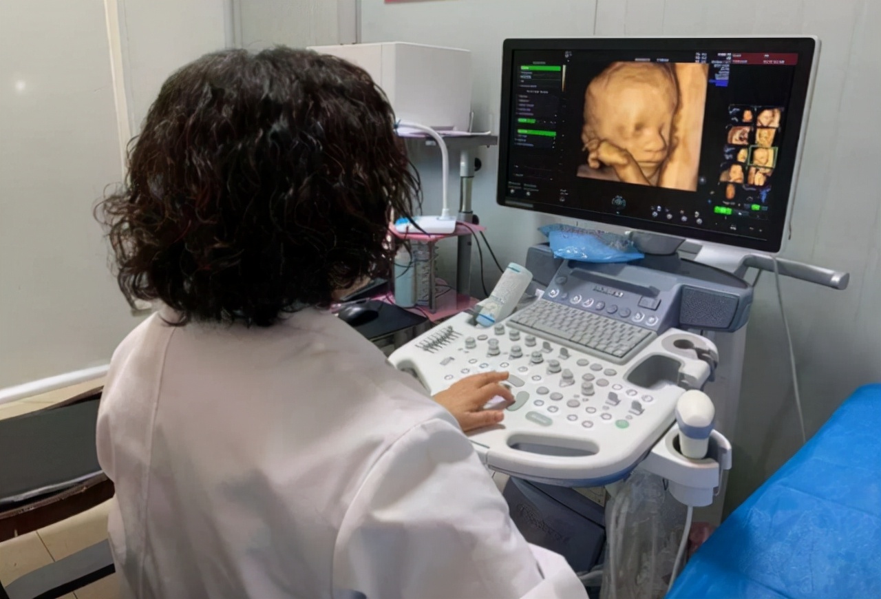 怀孕7个月以后要注意哪些事项,怀孕7个月以后需要注意什么事项