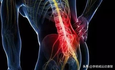 超详细的腰痛康复方案——腰痛自我评估、手法理疗和康复训练全解