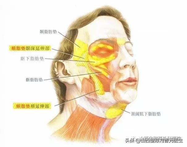 吸脂应该知道的秘密,面部吸脂真实经历视频