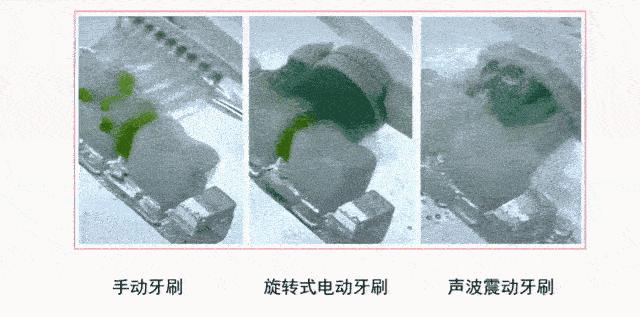 牙黄最有效变白方法,牙黄变白的正确方法学生党