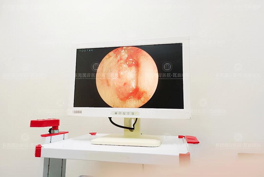 上海鼓膜穿孔修补手术多少钱,儿童鼓膜穿孔不建议手术修补