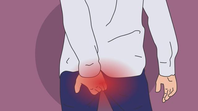 修灸治疗痔疮怎么样,治疗痔疮最好的软膏