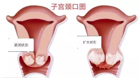 真不是骗你：你赢了所有精子？错！
