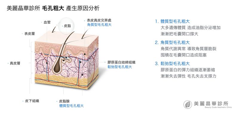 控油清洁毛孔,清洁控油收缩毛孔步骤