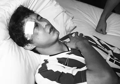 足坛十大受伤瞬间,中国足球十大球员受伤视频