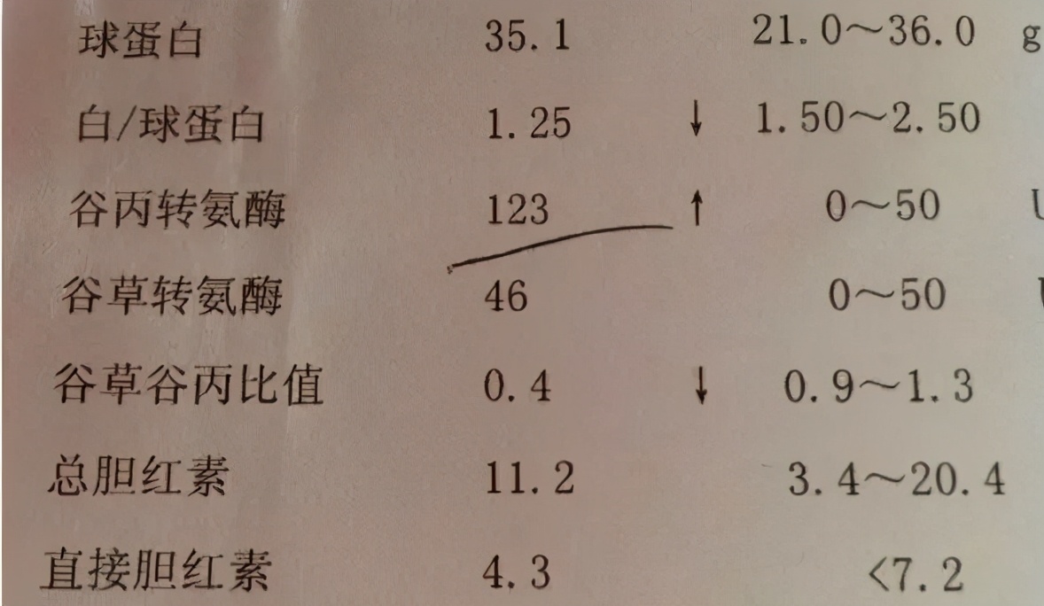 转氨酶升高的原因及解决方法,转氨酶持续升高要怎么治疗