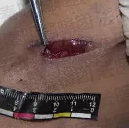 法医讲述尸体分析,法医在尸体中找到真相